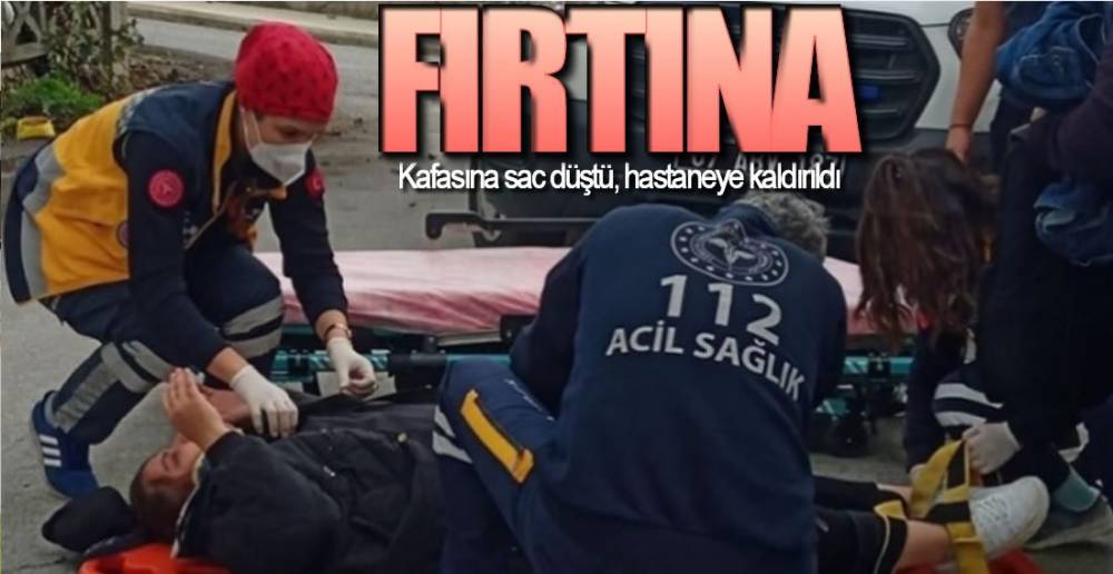 KAFASINA SAC DÜŞTÜ !