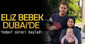 ELİZ BEBEK'iN TEDAVİSİNE BAŞLANDI